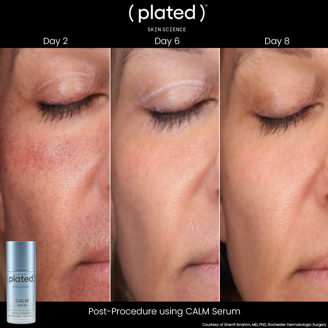 plated CALM Serum
